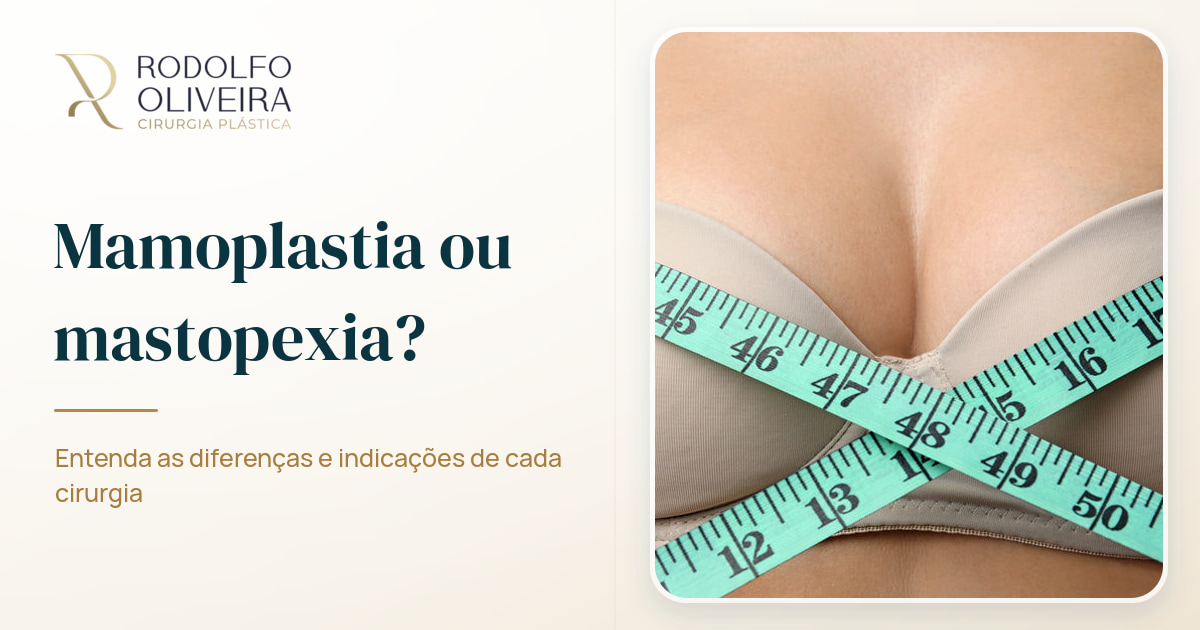 Imagem de capa do artigo Existe diferença entre mamoplastia e mastopexia?