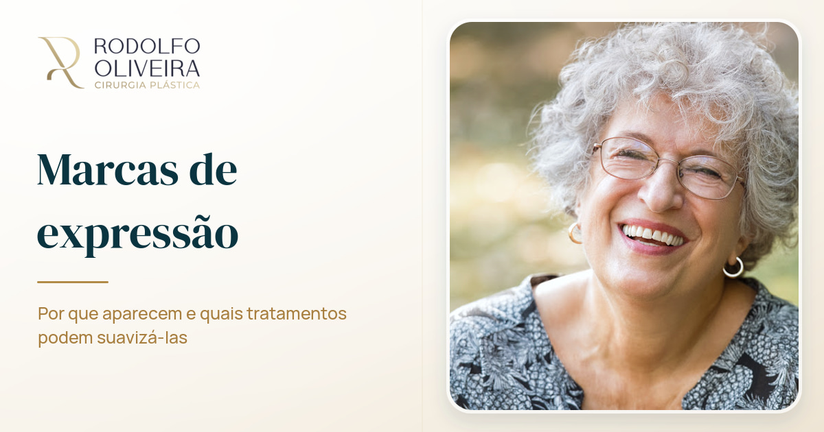 Imagem de capa do artigo Você sabe o que são marcas de expressão?