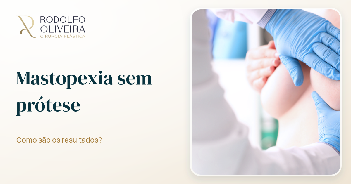 Imagem de capa do artigo Mastopexia sem prótese: como são os resultados?