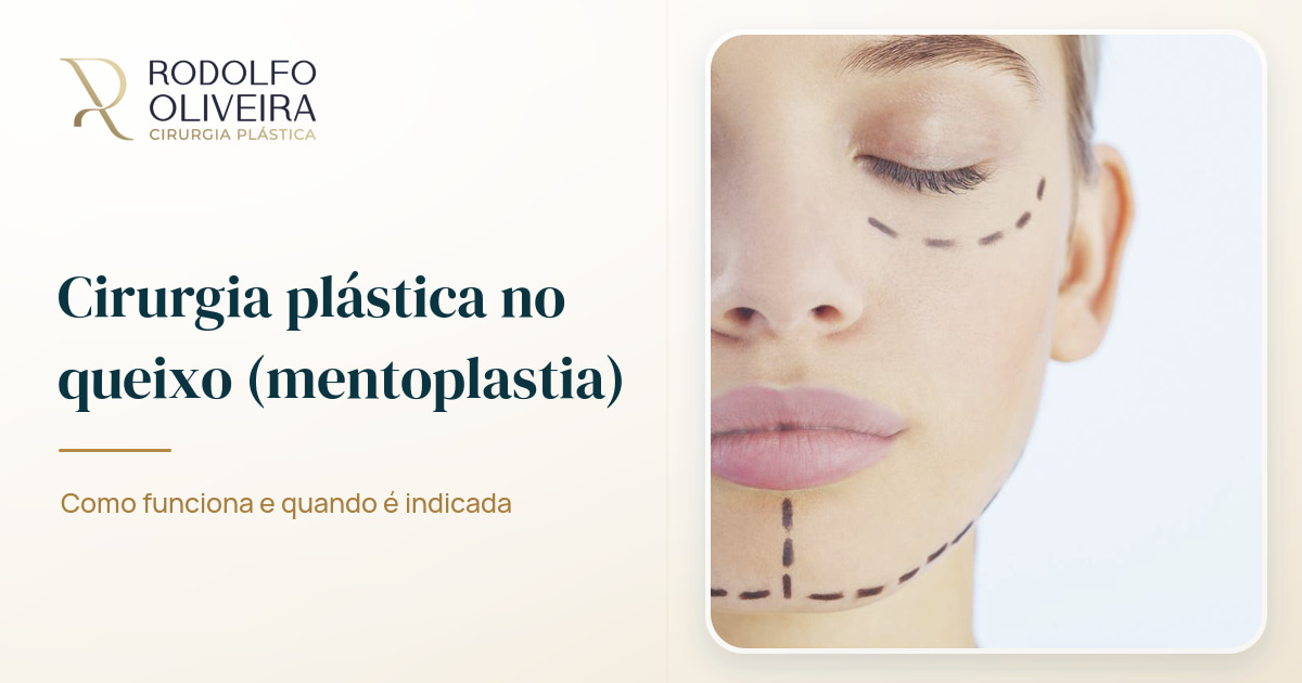 Imagem de capa do artigo Cirurgia plástica no queixo (mentoplastia): como funciona e quando é indicada