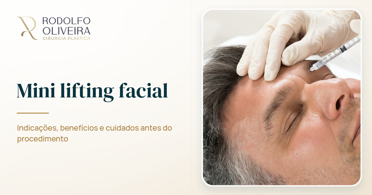 Imagem de capa do artigo Mini lifting facial: Conheça esta técnica