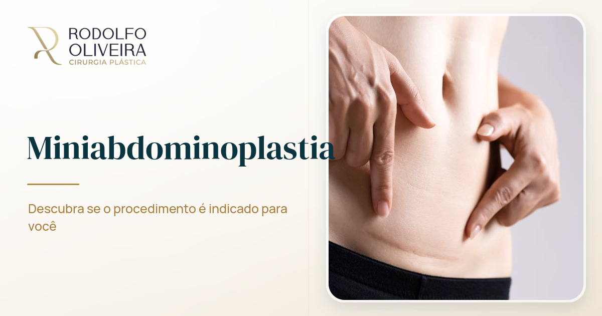 Imagem de capa do artigo Miniabdominoplastia: entenda se você pode fazer