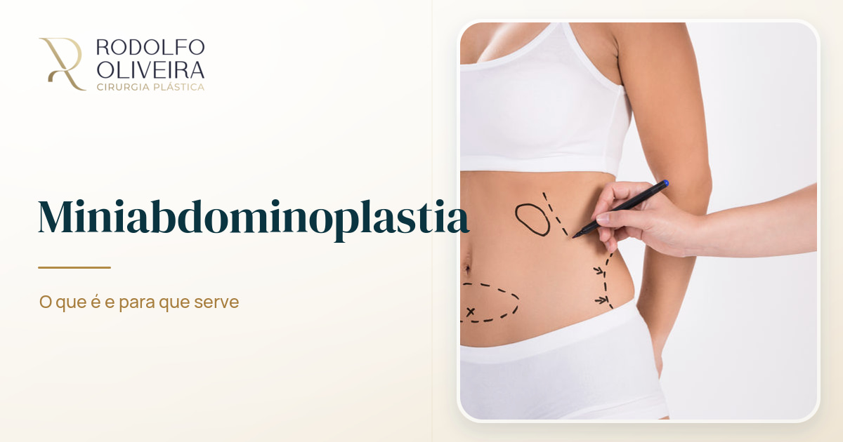 Imagem de capa do artigo Miniabdominoplastia: o que é e para que serve