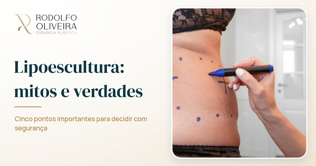 Imagem de capa do artigo 5 mitos e verdades sobre a lipoescultura