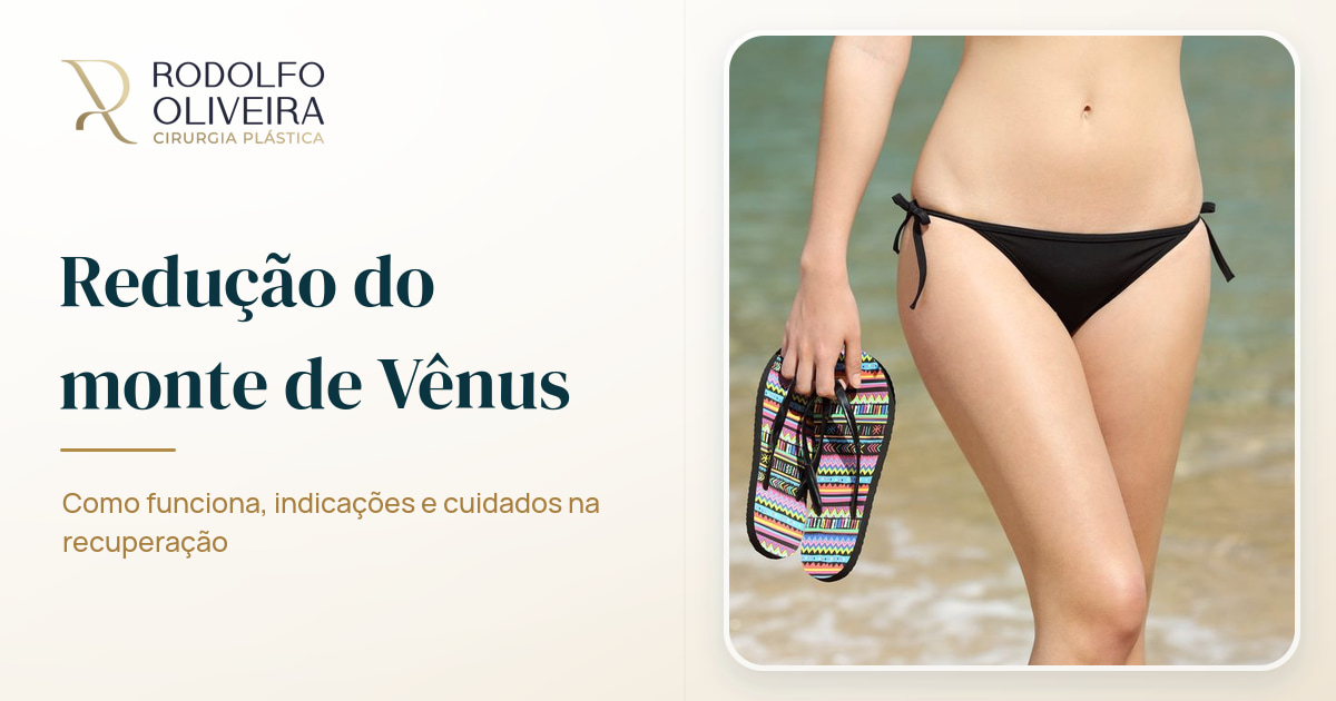 Imagem de capa do artigo O que é a cirurgia de redução do monte de Vênus?
