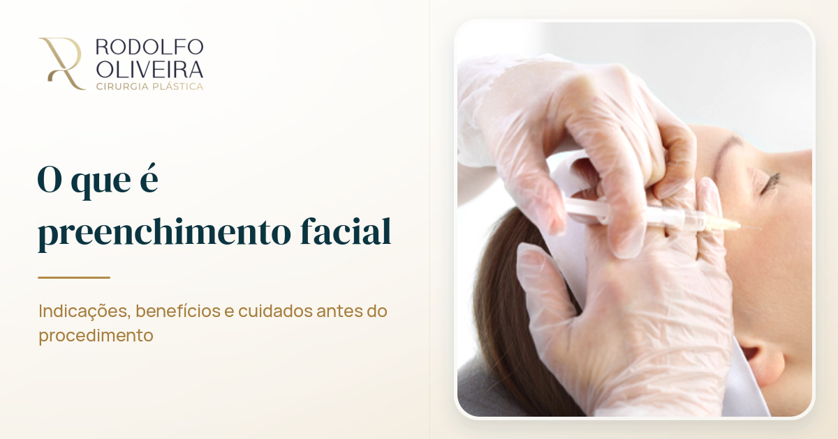 Imagem de capa do artigo O que é preenchimento facial?