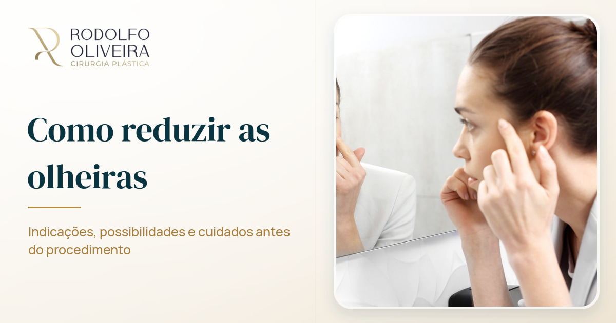 Imagem de capa do artigo Como reduzir as olheiras?