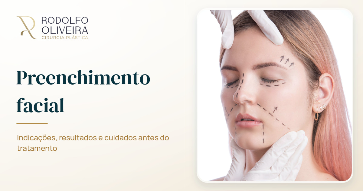 Imagem de capa do artigo Tudo que você precisa saber sobre preenchimento facial