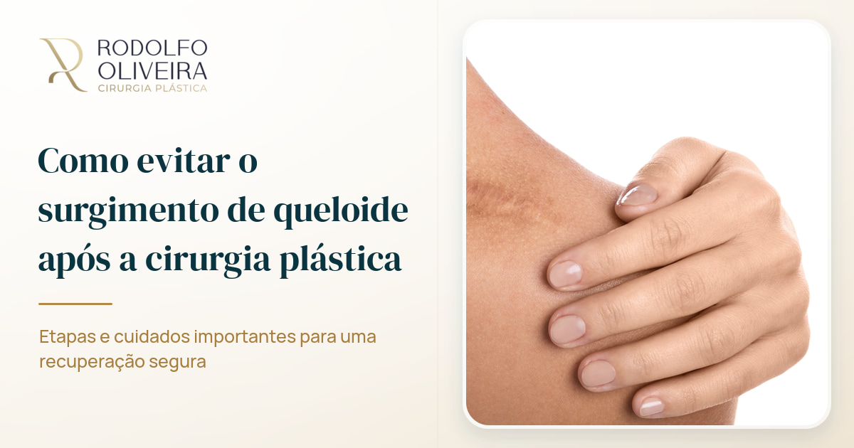 Imagem de capa do artigo Como evitar o surgimento de queloide após a cirurgia plástica