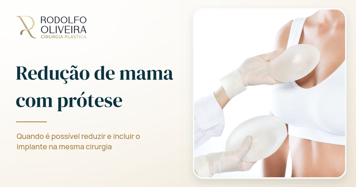 Imagem de capa do artigo Redução de mama com prótese é possível?