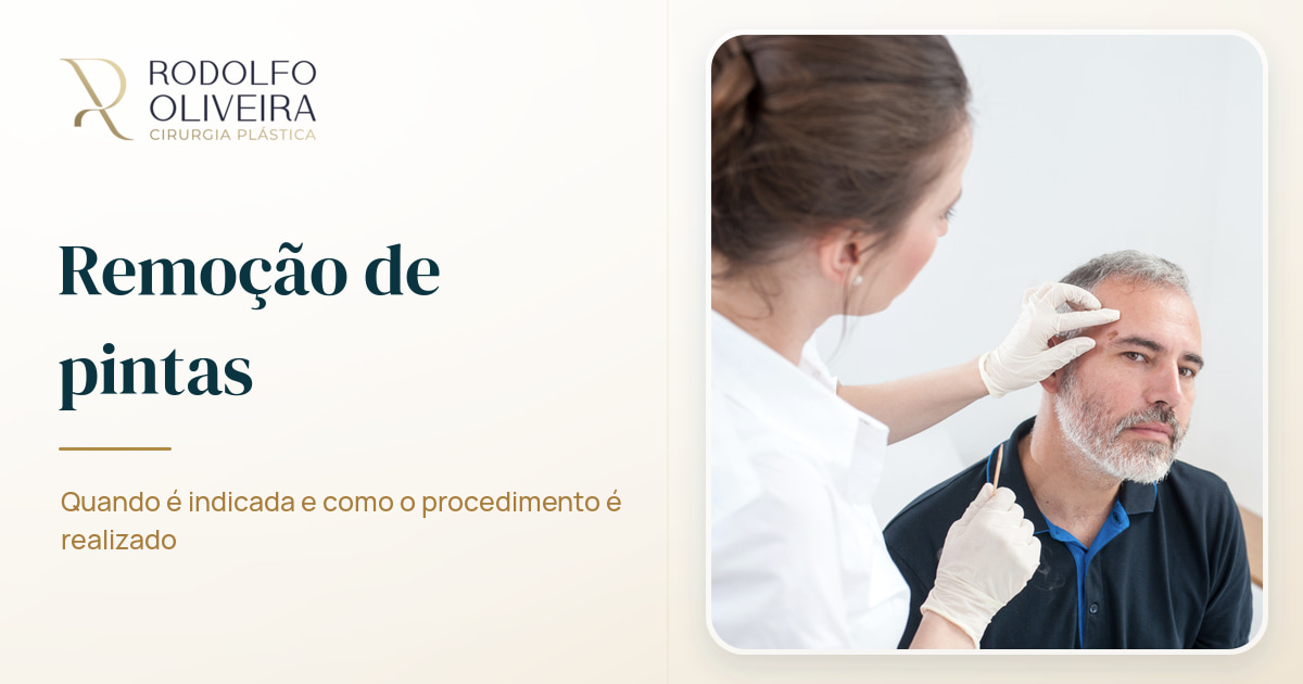 Imagem de capa do artigo Tire suas dúvidas sobre remoção de pintas