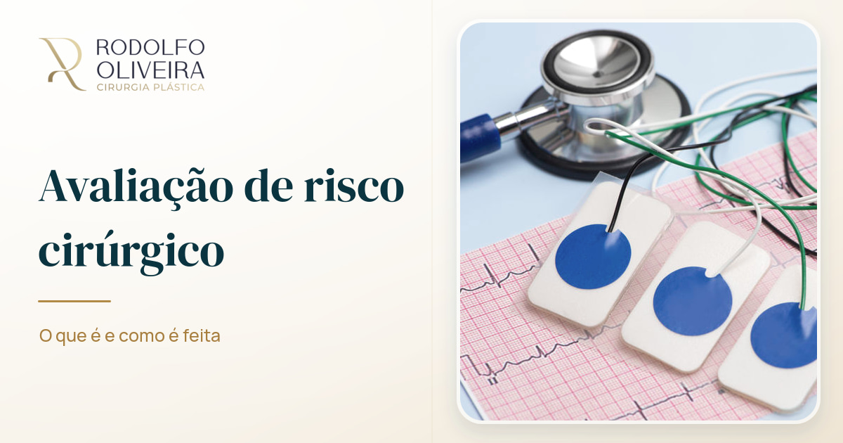 Imagem de capa do artigo Avaliação de risco cirúrgico: o que é e como é feita