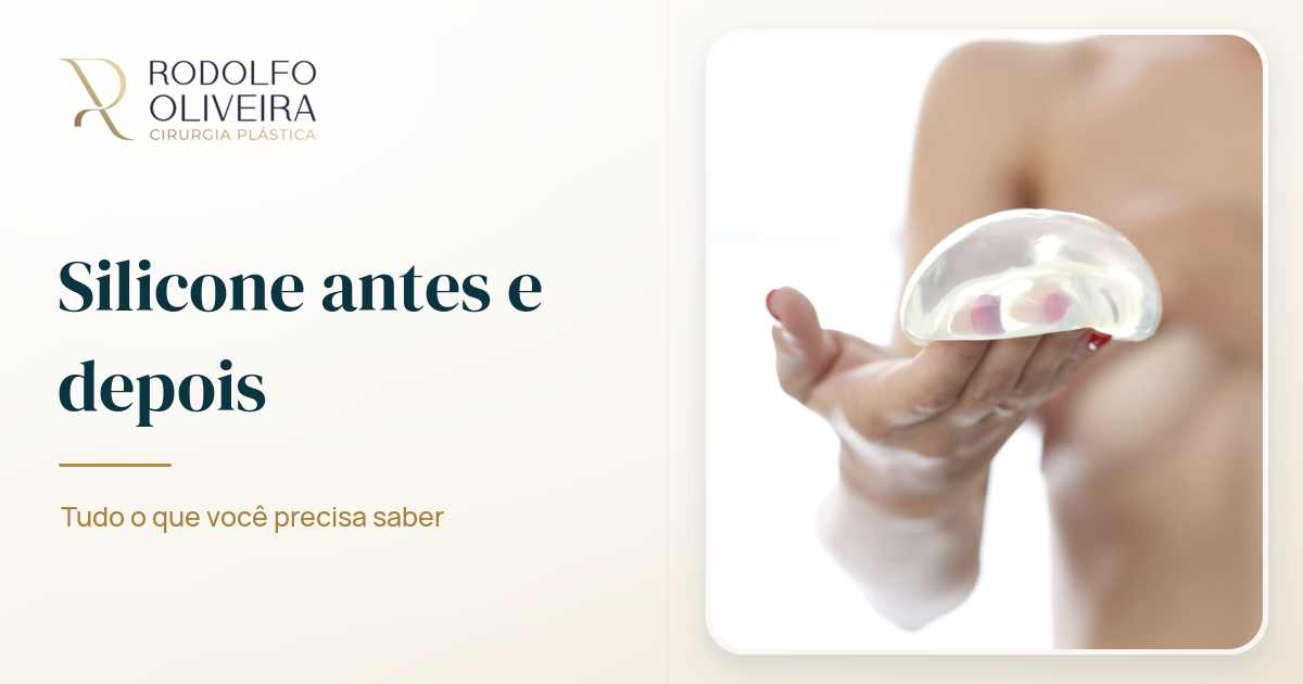 Imagem de capa do artigo Silicone antes e depois: tudo o que você precisa saber