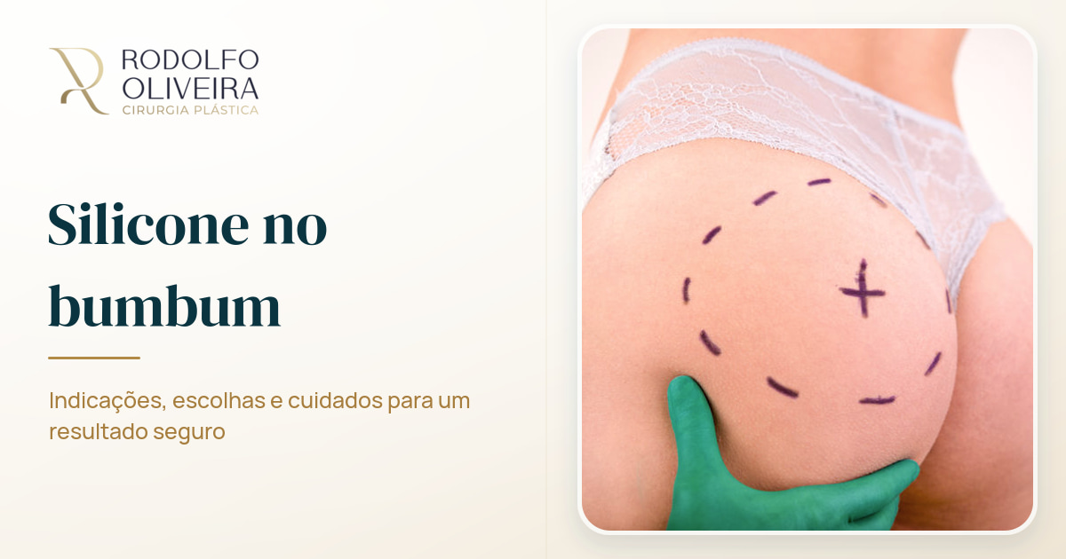 Imagem de capa do artigo Tudo sobre silicone no bumbum