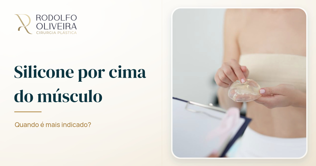 Imagem de capa do artigo Silicone por cima do músculo: quando é mais indicado?