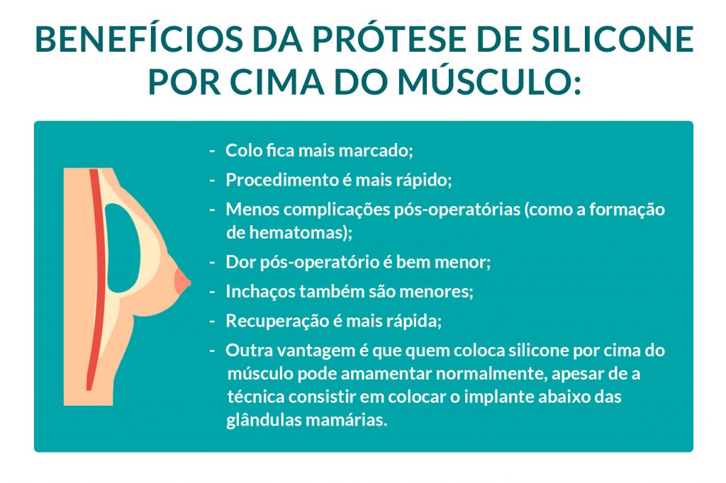 Silicone por cima do músculo: quando é mais indicado?