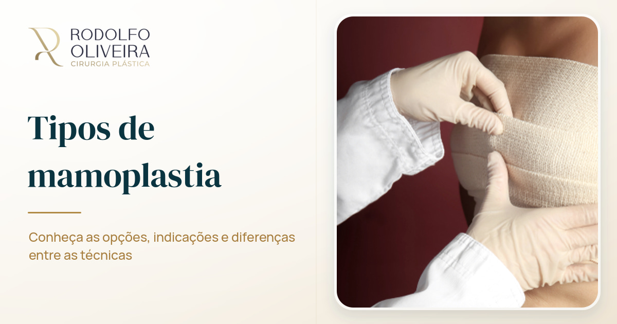 Imagem de capa do artigo Conheça os tipos de mamoplastia