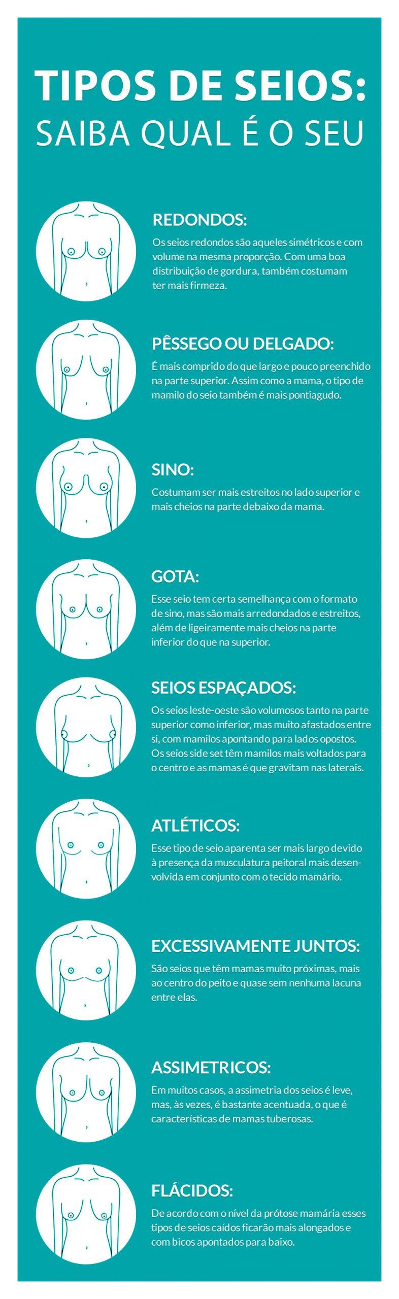 Tipos de seios Tipos de seios: saiba qual é o seu