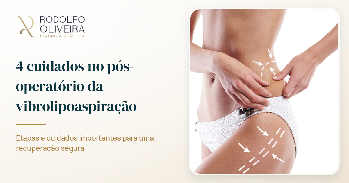 Imagem de capa do artigo 4 cuidados no pós-operatório da vibrolipoaspiração