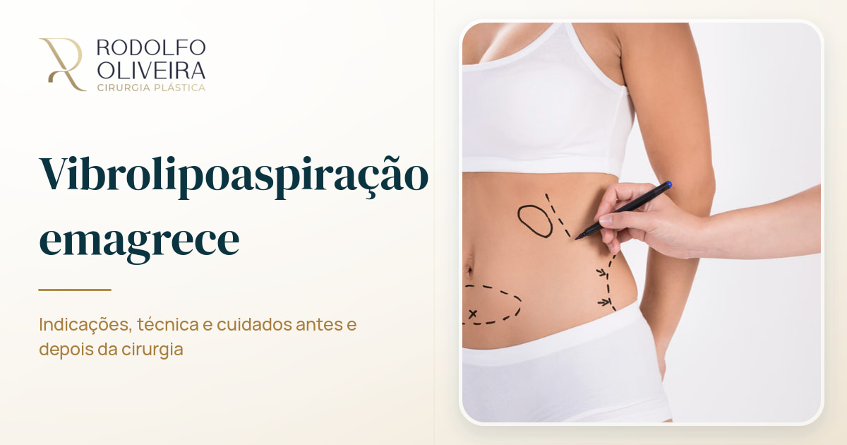 Imagem de capa do artigo Vibrolipoaspiração emagrece?