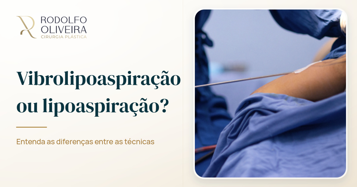 Imagem de capa do artigo Vibrolipoaspiração é melhor que lipoaspiração?