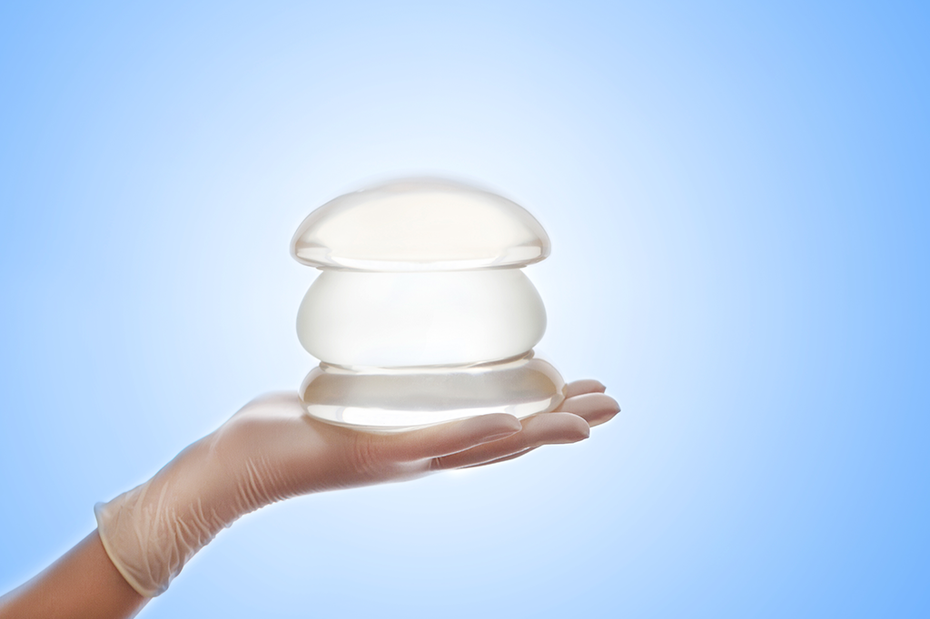 6 mitos e verdades sobre implante de silicone