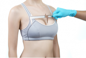 A mamoplastia de aumento é uma das cirurgias mais buscadas pelas mulheres, mas muitas podem ter dúvidas sobre o tamanho ideal da prótese.
