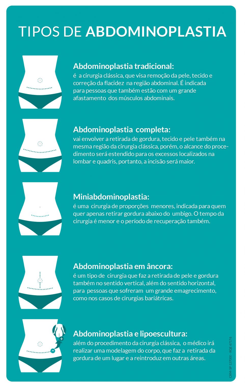 Dr Rodolfo Oliveira - Abdominoplastia e lipoescultura qual a diferença